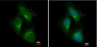 Immunocytochemistry/ Immunofluorescence - Anti-CDK5RAP1 antibody (AB154537)
