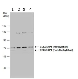 Western blot - Anti-CDK5RAP1 antibody (AB154537)