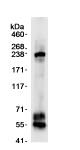 Immunoprecipitation - Anti-CDK5RAP2 antibody (AB70213)