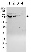 Western blot - Anti-CDK5RAP2 antibody (AB70213)
