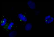 Immunocytochemistry/ Immunofluorescence - Anti-CDK5RAP2 antibody (AB86340)