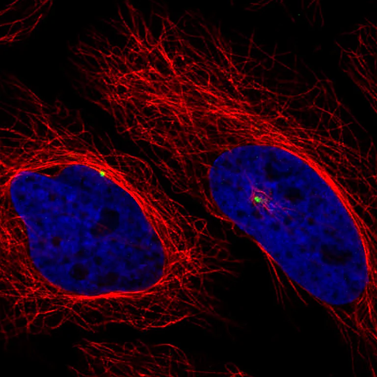 Immunocytochemistry/ Immunofluorescence - Anti-CDK5RAP2 Antibody [CL3392] (AB327115)