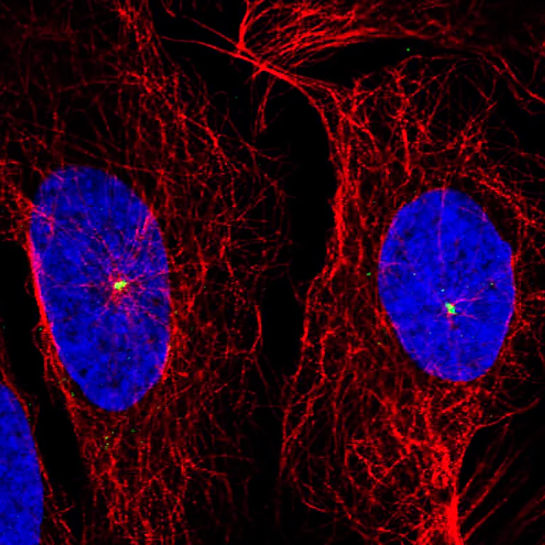 Immunocytochemistry/ Immunofluorescence - Anti-CDK5RAP2 Antibody [CL3392] (AB327115)