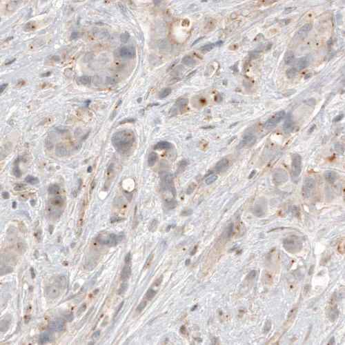 Immunohistochemistry (Formalin/PFA-fixed paraffin-embedded sections) - Anti-CDK5RAP2 Antibody [CL3392] (AB327115)