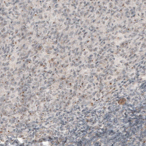 Immunohistochemistry (Formalin/PFA-fixed paraffin-embedded sections) - Anti-CDK5RAP2 Antibody [CL3392] (AB327115)