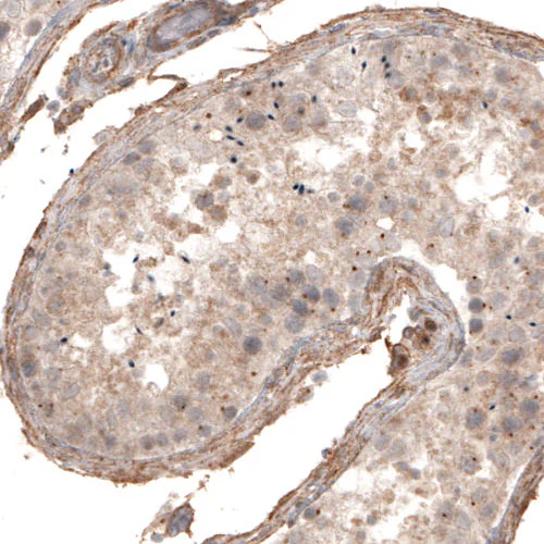 Immunohistochemistry (Formalin/PFA-fixed paraffin-embedded sections) - Anti-CDK5RAP2 Antibody [CL3392] (AB327115)