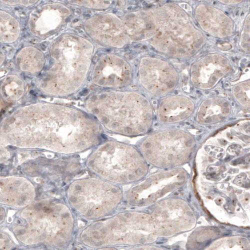 Immunohistochemistry (Formalin/PFA-fixed paraffin-embedded sections) - Anti-CDK5RAP2 Antibody [CL3392] (AB327115)