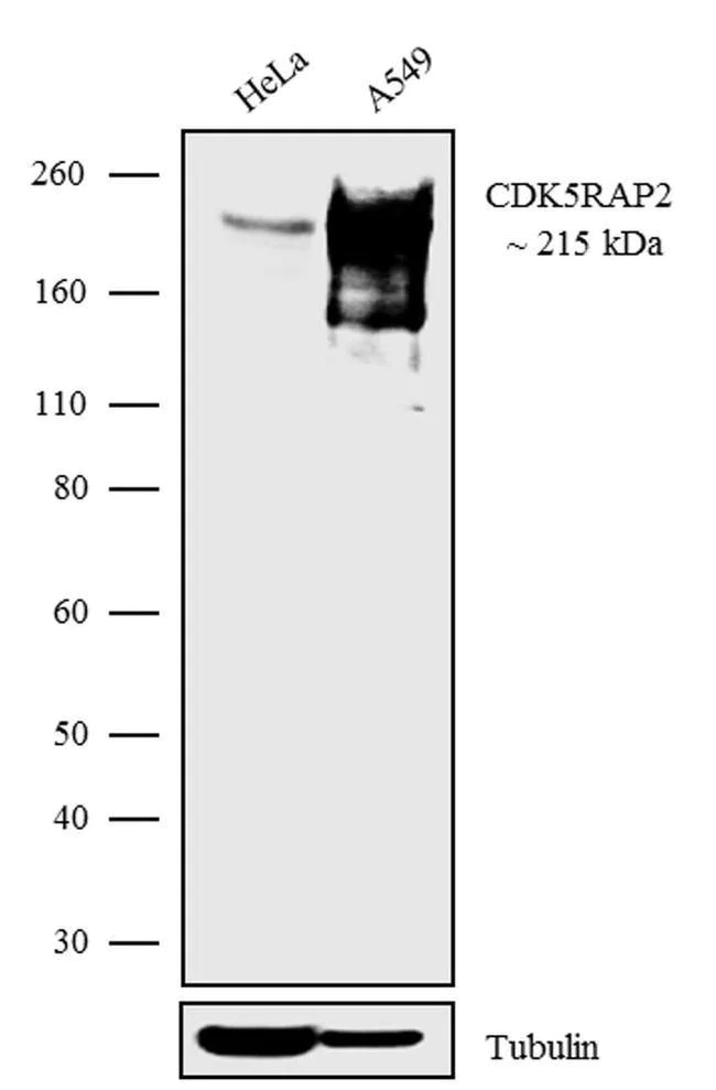 Western blot - Anti-CDK5RAP2 Antibody [RP23040190] (AB313477)