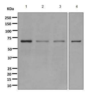 Western blot - Anti-CDK5RAP3 antibody [EPR11293] (AB168353)