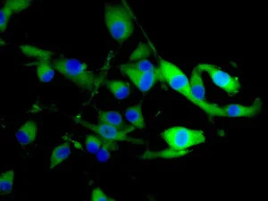 Immunocytochemistry/ Immunofluorescence - Anti-CDK5RAP3 antibody [EPR11293] - BSA and Azide free (AB249450)