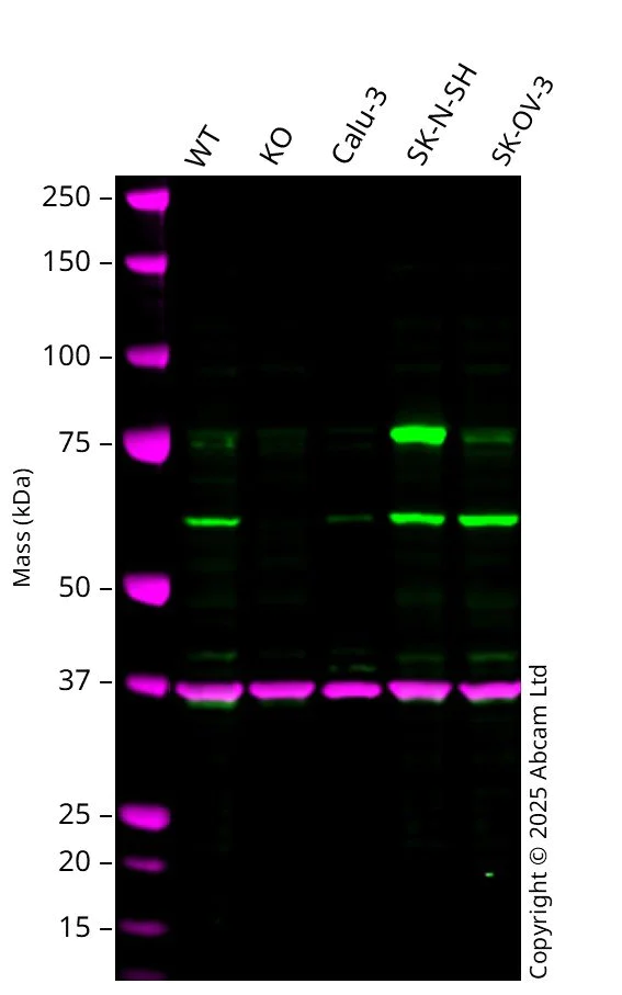 Western blot - Anti-CDK5RAP3 antibody [EPR11293] - BSA and Azide free (AB249450)