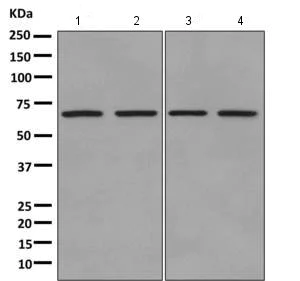 Western blot - Anti-CDK5RAP3 antibody [EPR11294(B)] (AB157203)