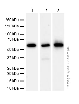 Western blot - Anti-CDK5RAP3 antibody [EPR11294(B)] (AB157203)