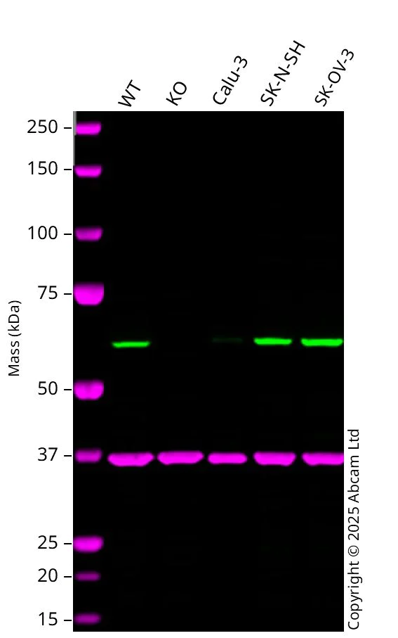 Western blot - Anti-CDK5RAP3 antibody [EPR11294(B)] (AB157203)