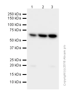 Western blot - Anti-CDK5RAP3 antibody [EPR11294(B)] (AB157203)
