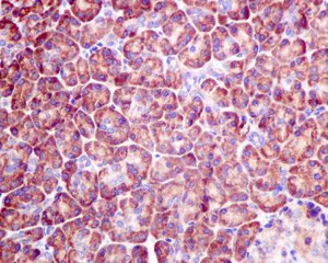 Immunohistochemistry (Formalin/PFA-fixed paraffin-embedded sections) - Anti-CDK5RAP3 antibody [EPR11294(B)] - BSA and Azide free (AB242399)