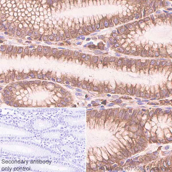 Immunohistochemistry (Formalin/PFA-fixed paraffin-embedded sections) - Anti-CDK5RAP3 antibody [EPR11294(B)] - BSA and Azide free (AB242399)