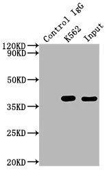 Immunoprecipitation - Anti-Cdk6 antibody [8G3] (AB288368)