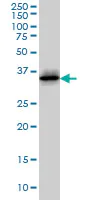 Western blot - Anti-Cdk6 antibody [8H4] (AB54576)