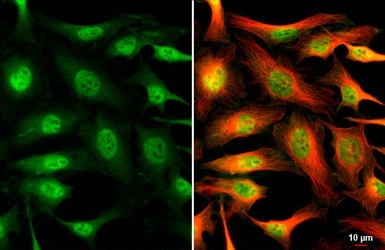 Anti-Cdk6 antibody (ab151247) | Abcam