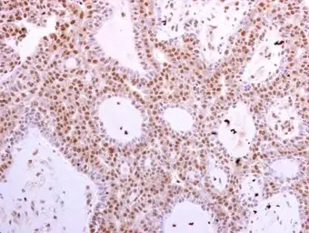 Immunohistochemistry (Formalin/PFA-fixed paraffin-embedded sections) - Anti-Cdk6 antibody (AB151247)