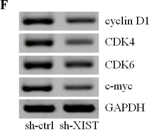 Western blot - Anti-Cdk6 antibody (AB151247)