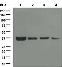 Western blot - Anti-Cdk6 antibody [EPR4515] (AB124821)