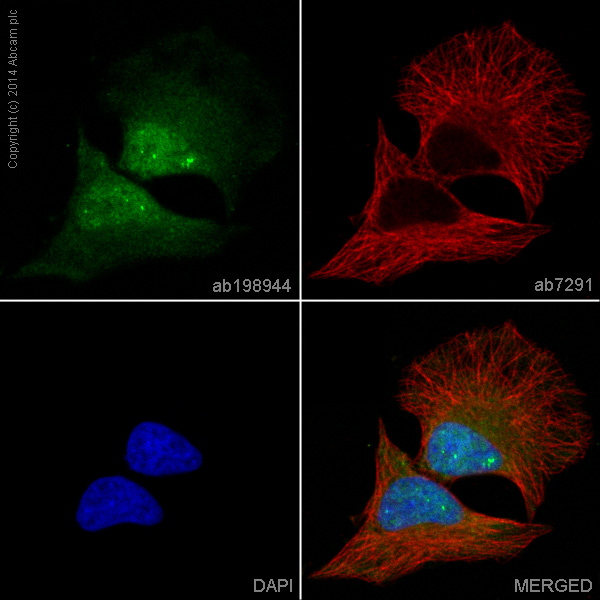 Immunocytochemistry/ Immunofluorescence - Anti-Cdk6 antibody [EPR4515] - BSA and Azide free (AB222395), expandable thumbnail