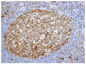 Immunohistochemistry (Formalin/PFA-fixed paraffin-embedded sections) - Anti-Cdk6 antibody [EPR4515] - BSA and Azide free (AB222395), expandable thumbnail
