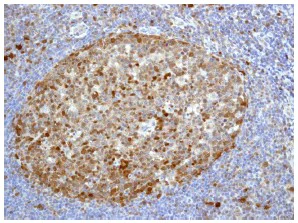 Immunohistochemistry (Formalin/PFA-fixed paraffin-embedded sections) - Anti-Cdk6 antibody [EPR4515] - BSA and Azide free (AB222395)