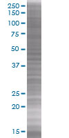 Cdk6 overexpression 293T lysate (whole cell)