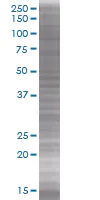 SDS-PAGE - Cdk6 overexpression 293T lysate (whole cell) (AB94291)