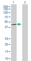Western blot - Cdk6 overexpression 293T lysate (whole cell) (AB94291)
