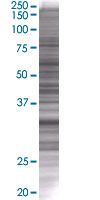 Cdk6 overexpression 293T lysate (whole cell)