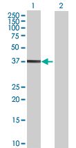 Western blot - Cdk6 overexpression 293T lysate (whole cell) (AB94292)