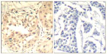 Immunohistochemistry (Formalin/PFA-fixed paraffin-embedded sections) - Anti-Cdk6 (phospho Y13) antibody (AB131439)