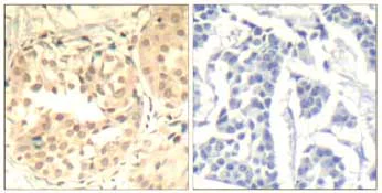 Immunohistochemistry (Formalin/PFA-fixed paraffin-embedded sections) - Anti-Cdk6 (phospho Y13) antibody (AB131439)