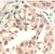 Immunohistochemistry (Formalin/PFA-fixed paraffin-embedded sections) - Anti-Cdk6 (phospho Y13) antibody (AB194871)