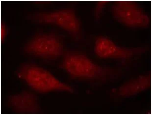 Immunocytochemistry/ Immunofluorescence - Anti-Cdk6 (phospho Y24) antibody (AB131469)