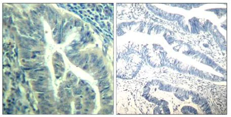Immunohistochemistry (Formalin/PFA-fixed paraffin-embedded sections) - Anti-Cdk6 (phospho Y24) antibody (AB131469)