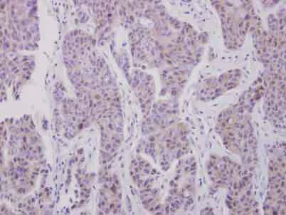 Immunohistochemistry (Formalin/PFA-fixed paraffin-embedded sections) - Anti-Cdk7 antibody (AB137716)