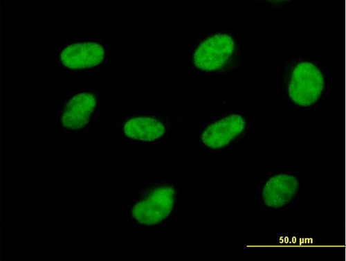Immunocytochemistry/ Immunofluorescence - Anti-Cdk7 antibody (AB167565)