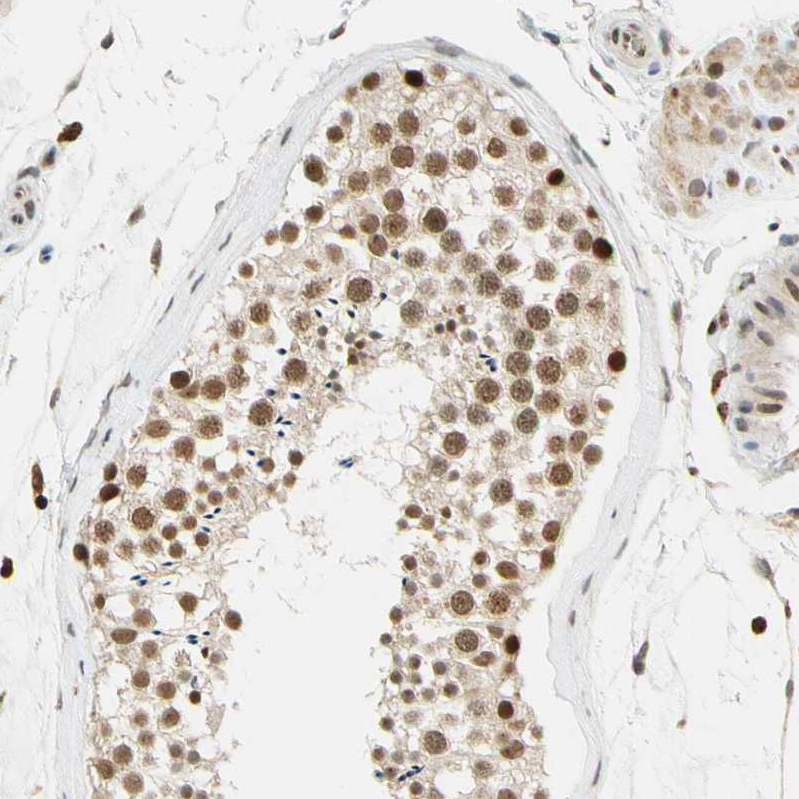 Immunohistochemistry (Formalin/PFA-fixed paraffin-embedded sections) - Anti-Cdk7 antibody (AB262854), expandable thumbnail