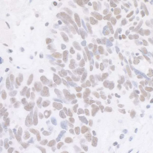 Immunohistochemistry (Formalin/PFA-fixed paraffin-embedded sections) - Anti-Cdk7 antibody [BL-80-3D4] (AB243863)