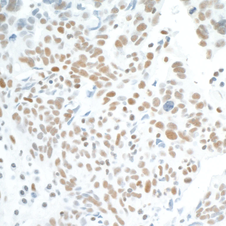 Immunohistochemistry (Formalin/PFA-fixed paraffin-embedded sections) - Anti-Cdk7 antibody [BL-80-3D4] (AB243863)