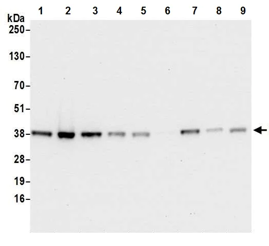 Western blot - Anti-Cdk7 antibody [BL-80-3D4] (AB243863)