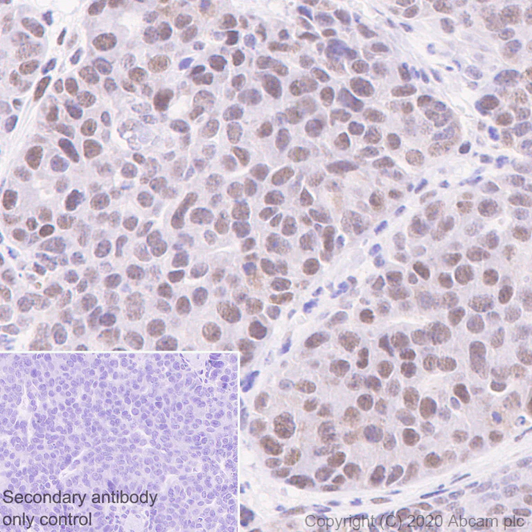 Immunohistochemistry (Formalin/PFA-fixed paraffin-embedded sections) - Anti-Cdk7 antibody [EPR23695-115] (AB256787)