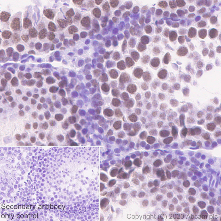 Immunohistochemistry (Formalin/PFA-fixed paraffin-embedded sections) - Anti-Cdk7 antibody [EPR23695-115] (AB256787)