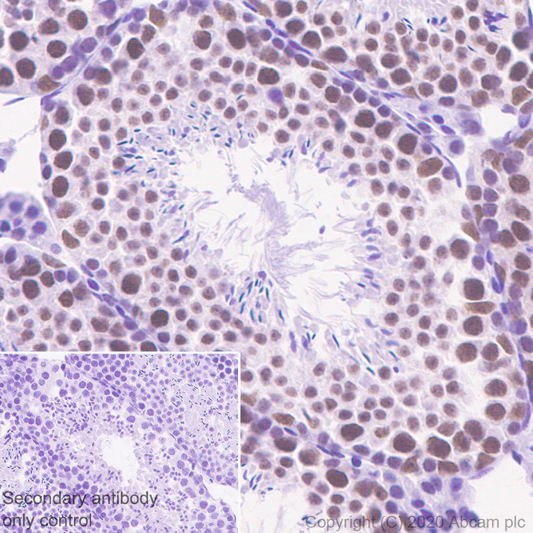 Immunohistochemistry (Formalin/PFA-fixed paraffin-embedded sections) - Anti-Cdk7 antibody [EPR23695-115] - BSA and Azide free (AB273630)