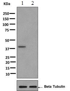 Western blot - Anti-Cdk7 (phospho T170) antibody [EPR6650(2)] (AB155976)